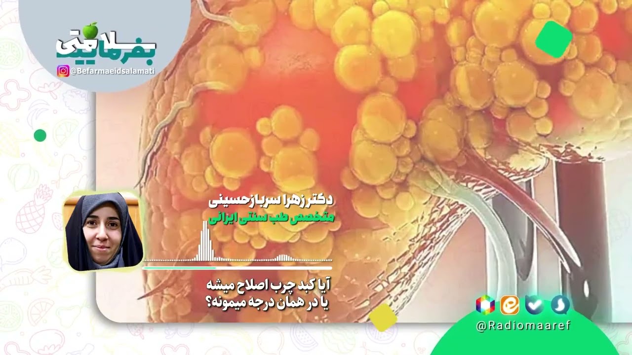 درمان کبد چرب: از گرید ۱ تا ۳ قابل برگشت است؟ #کبدچرب #درمان #سلامتی