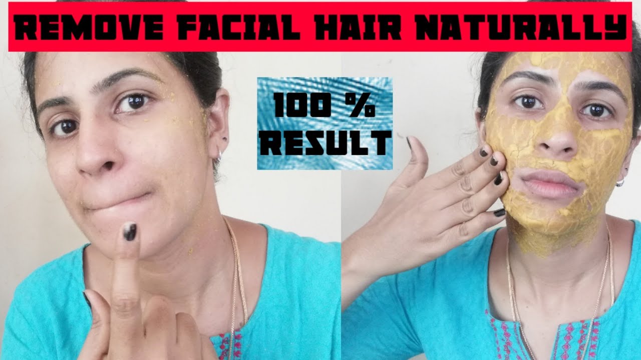 REMOVE FACIAL HAIR PERMANENTLY | முகத்தில் உள்ள தேவையில்லாத முடிகளை நீக்குவது எப்படி
