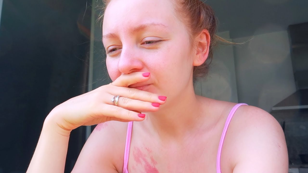 VLOG: ТРЕШ С ЛИНГВАЛЬНЫМИ БРЕКЕТАМИ! 10.07.18