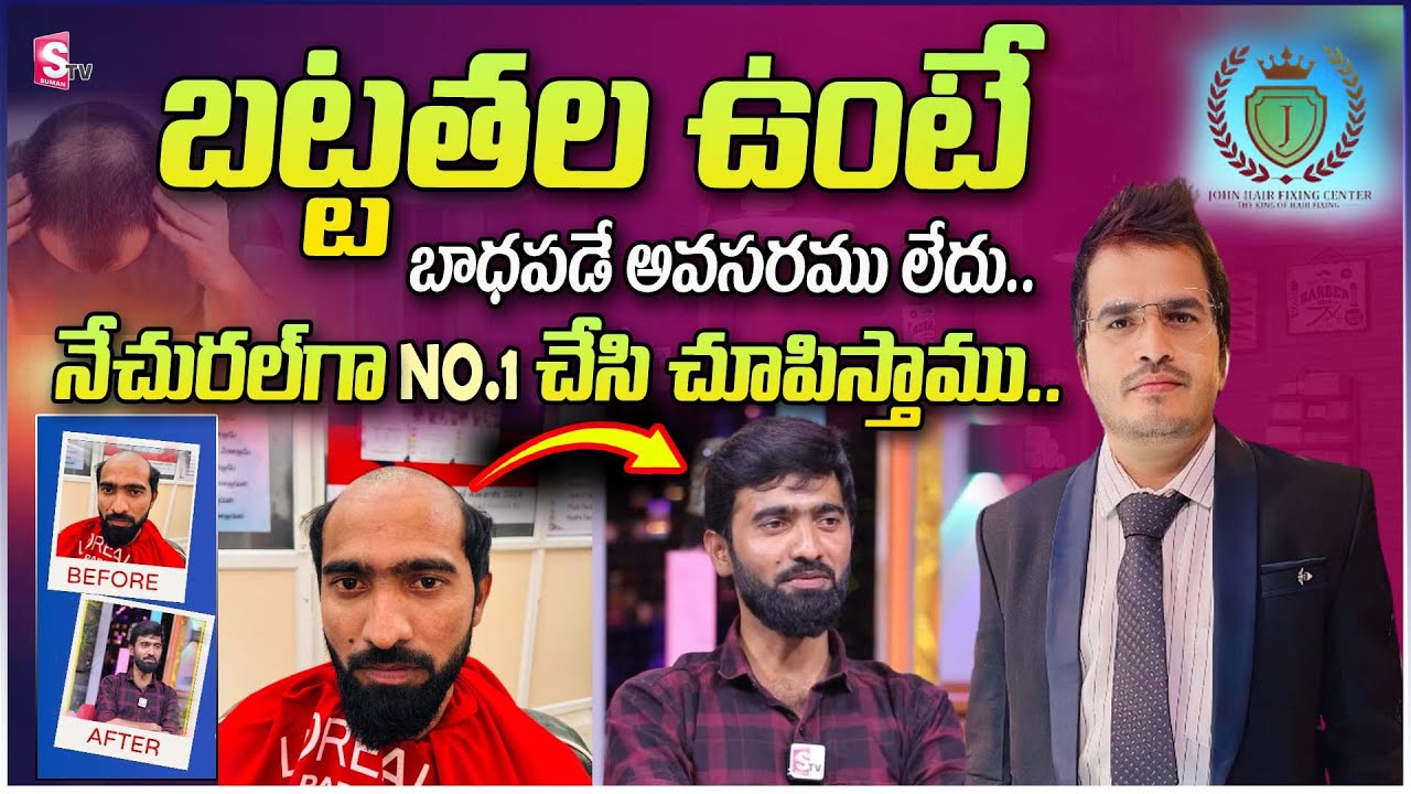 Best Hair Fixing in India No1 Hair  Fixing in Hydrabad | ‪John Hair Fixing Center | @SumanTVChannel‬