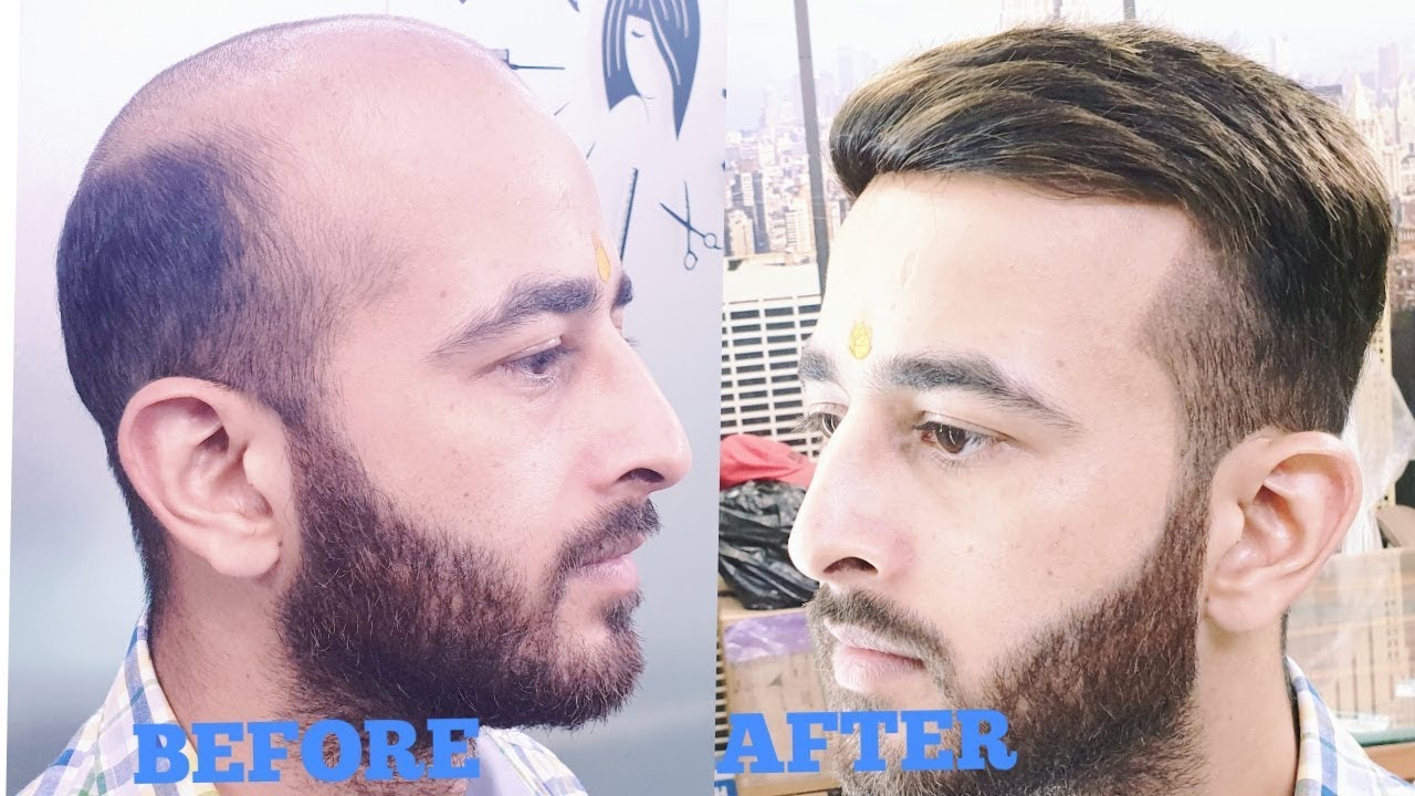 HAIR PATCH formal hair style with coloring by master RIZY parmanent solution 01142225757