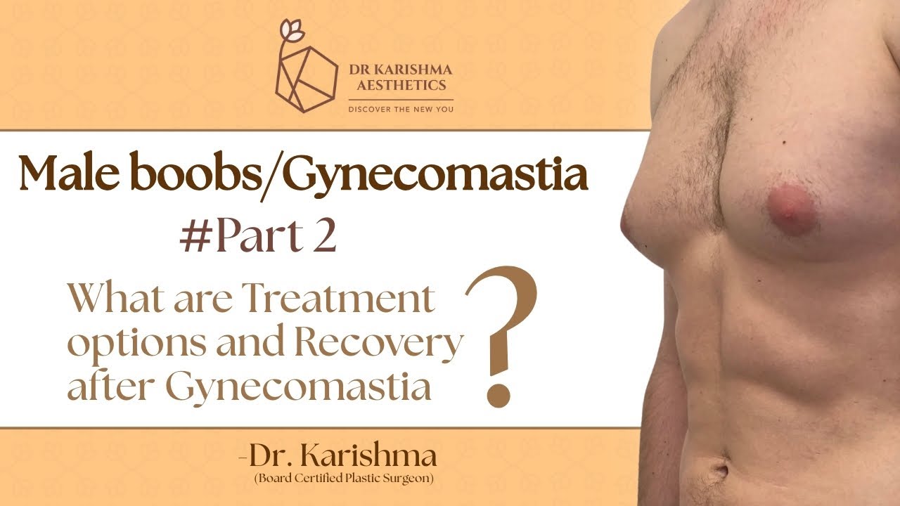 #Gynecomastia