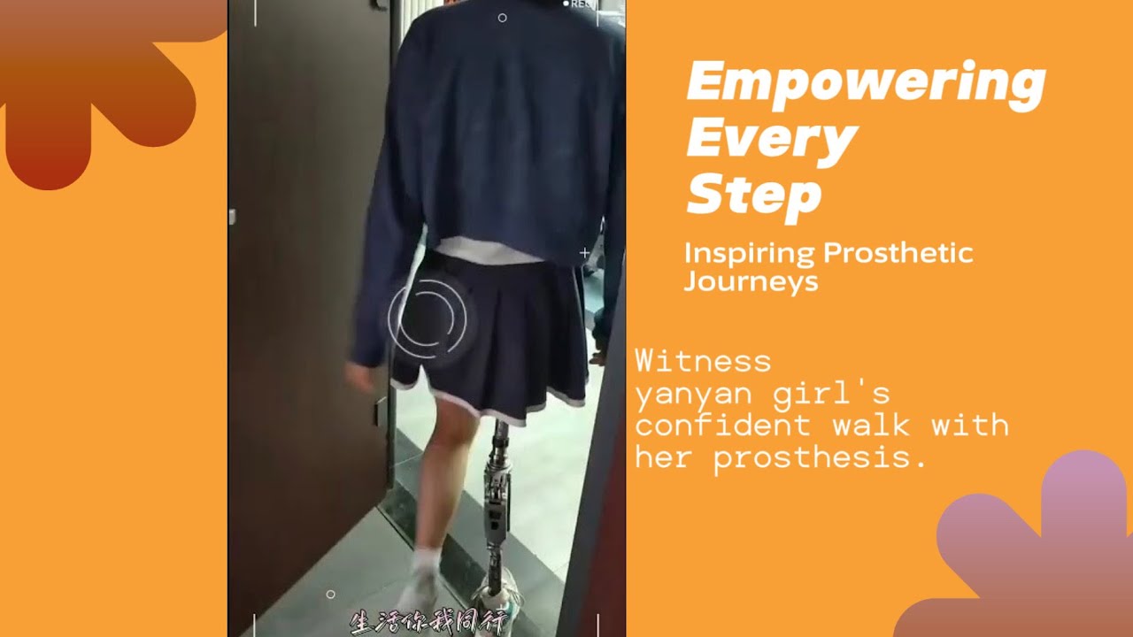 Amputee girl Wearing her prosthetic leg