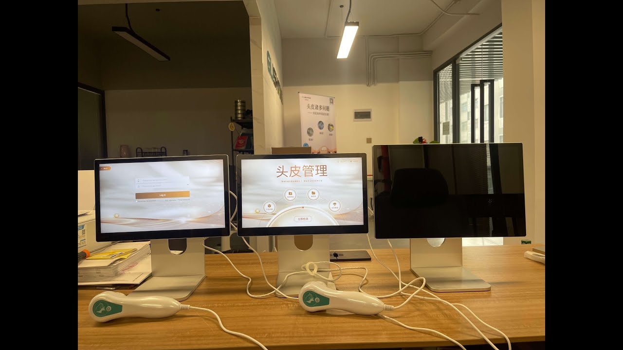 AI hair scalp analyzer analysis treatments for hair hairline loss tips for hair growth manufacturer
