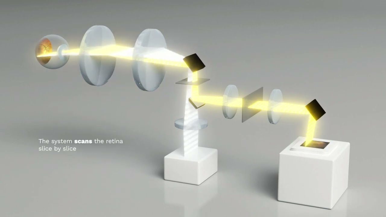 iCare EIDON UWF High Resolution Retinal Imaging