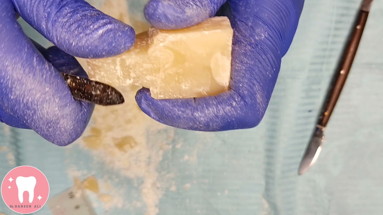mandibular central incisor carving on soap | نحت القاطع السفلي على الصابون @dr.haneenali1574