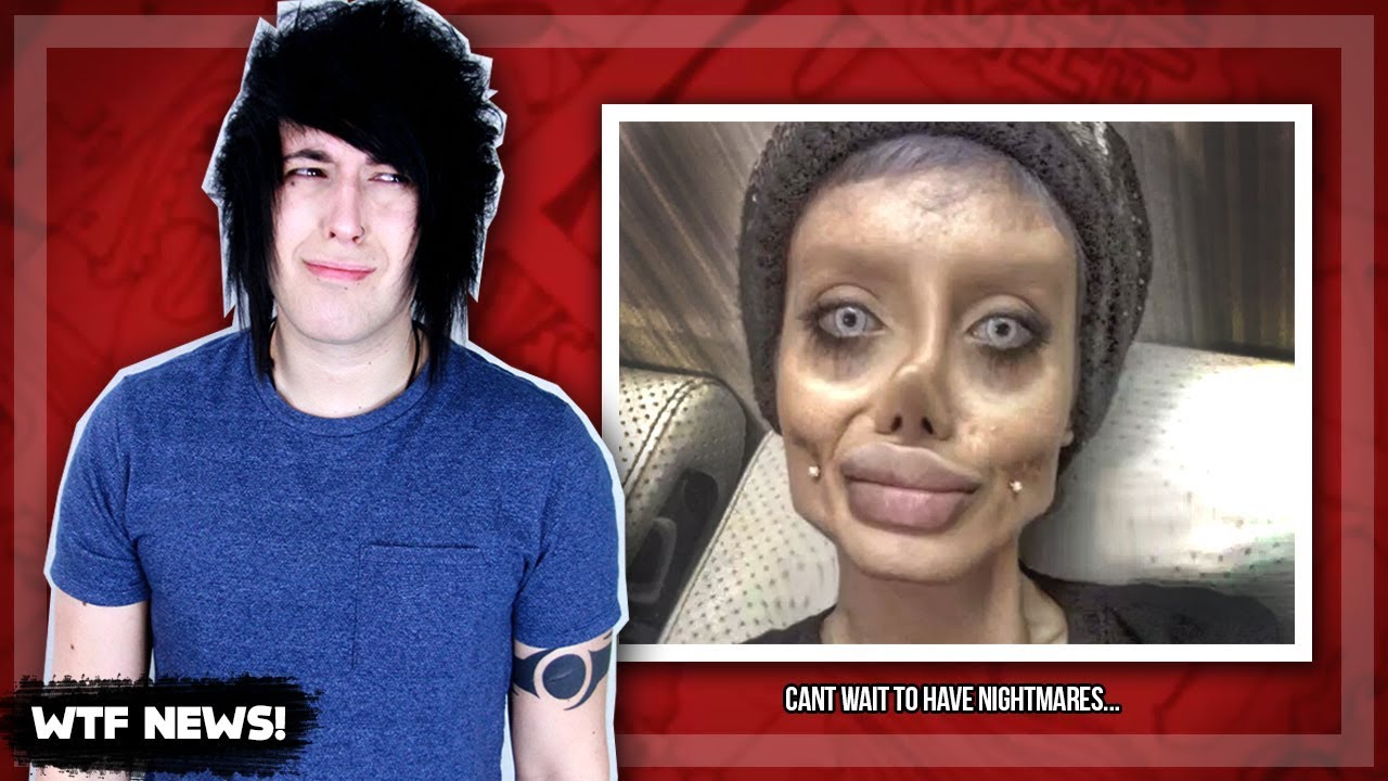 WOMAN'S PLASTIC SURGERY GOES HORRIBLY WRONG!! [WTF NEWS!]