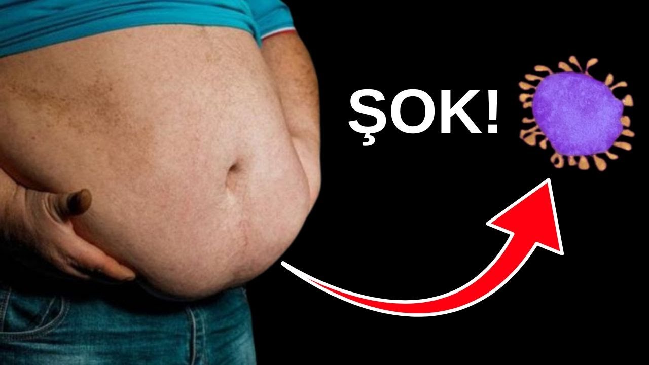 Sən demə, kökəlmənin əsl səbəbləri bunlar imiş! – Endokrinoloq Hidayət Məmmədzadə