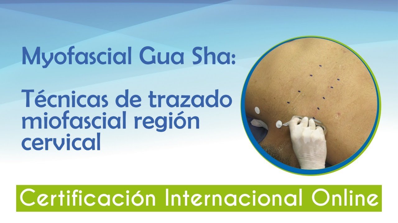 Técnicas de trazado Miofascial región cervical