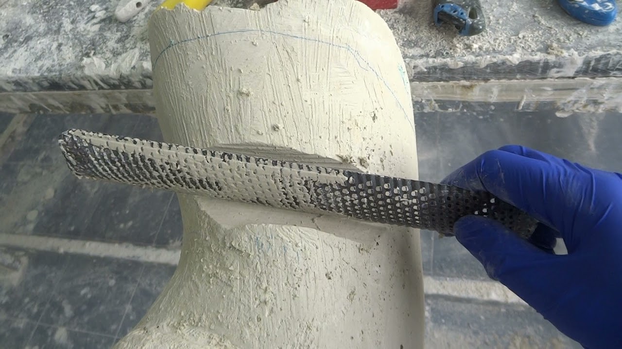 Cheneau brace modification IV