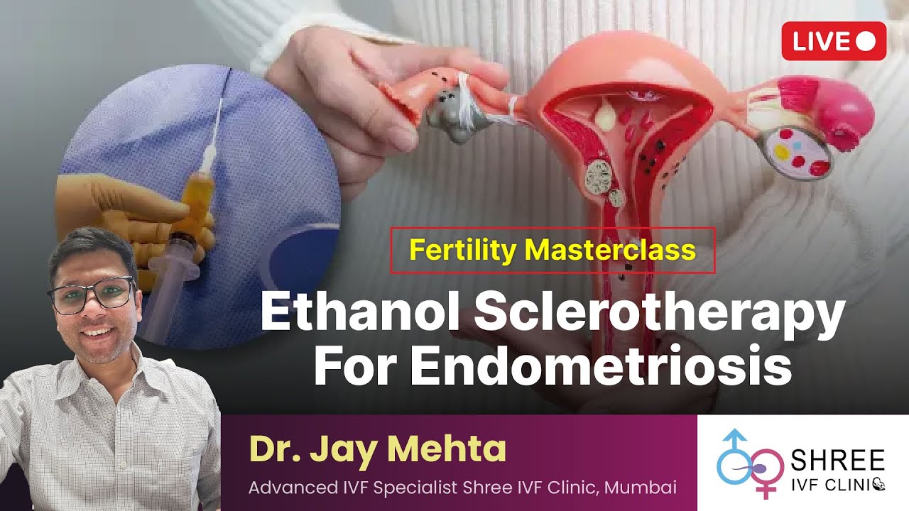 Fertility Masterclass 92: Ethanol Sclerotherapy for Endometriosis | Dr Jay Mehta