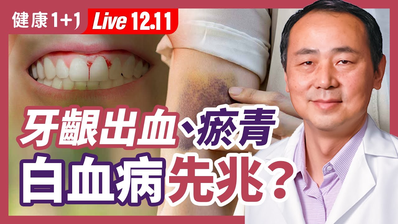 疲倦、牙齦出血、貧血症狀，可能是白血病！警惕血癌4大徵兆！血癌到底是什麼？能治癒嗎？| 健康1+1 · 直播