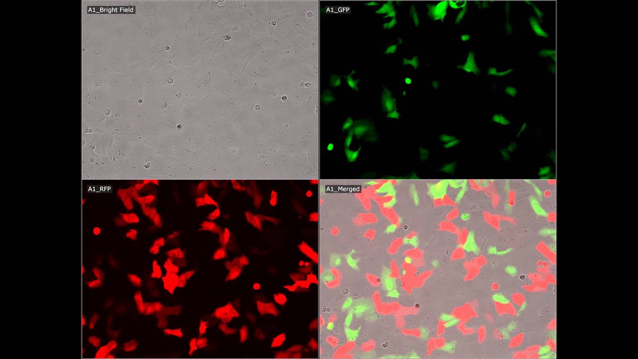[JuLI Stage Application Video] U2 OS cell GFP and RFP expression
