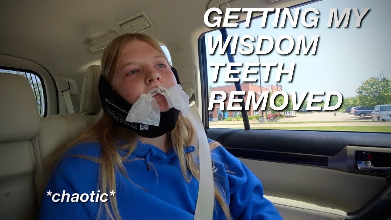 i got my WISDOM TEETH REMOVED! vlog