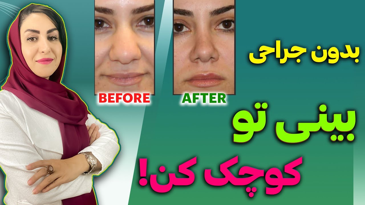 با این روغن معجزه گر و این ماساژ مخصوص بینی تو بدون عمل جراحی کوچک کن! | فرشته اسفیدانی