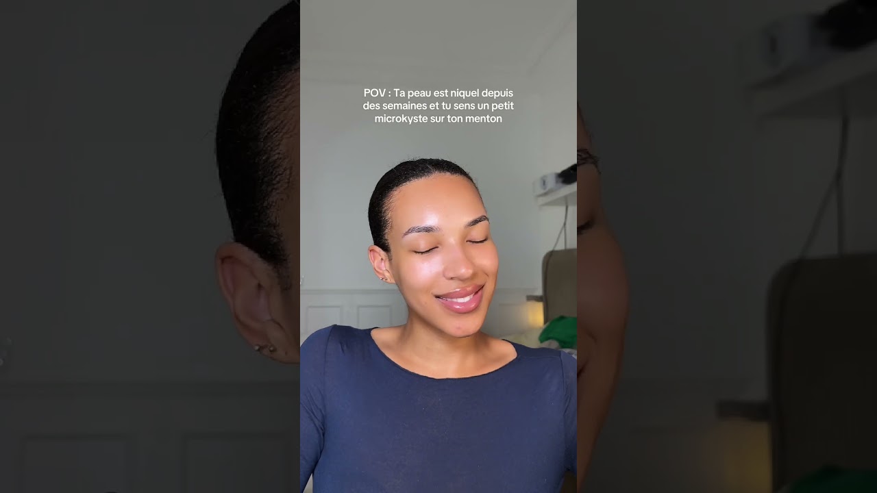 Un microkyste sur le menton? 🤔 #skincare #skin #acne