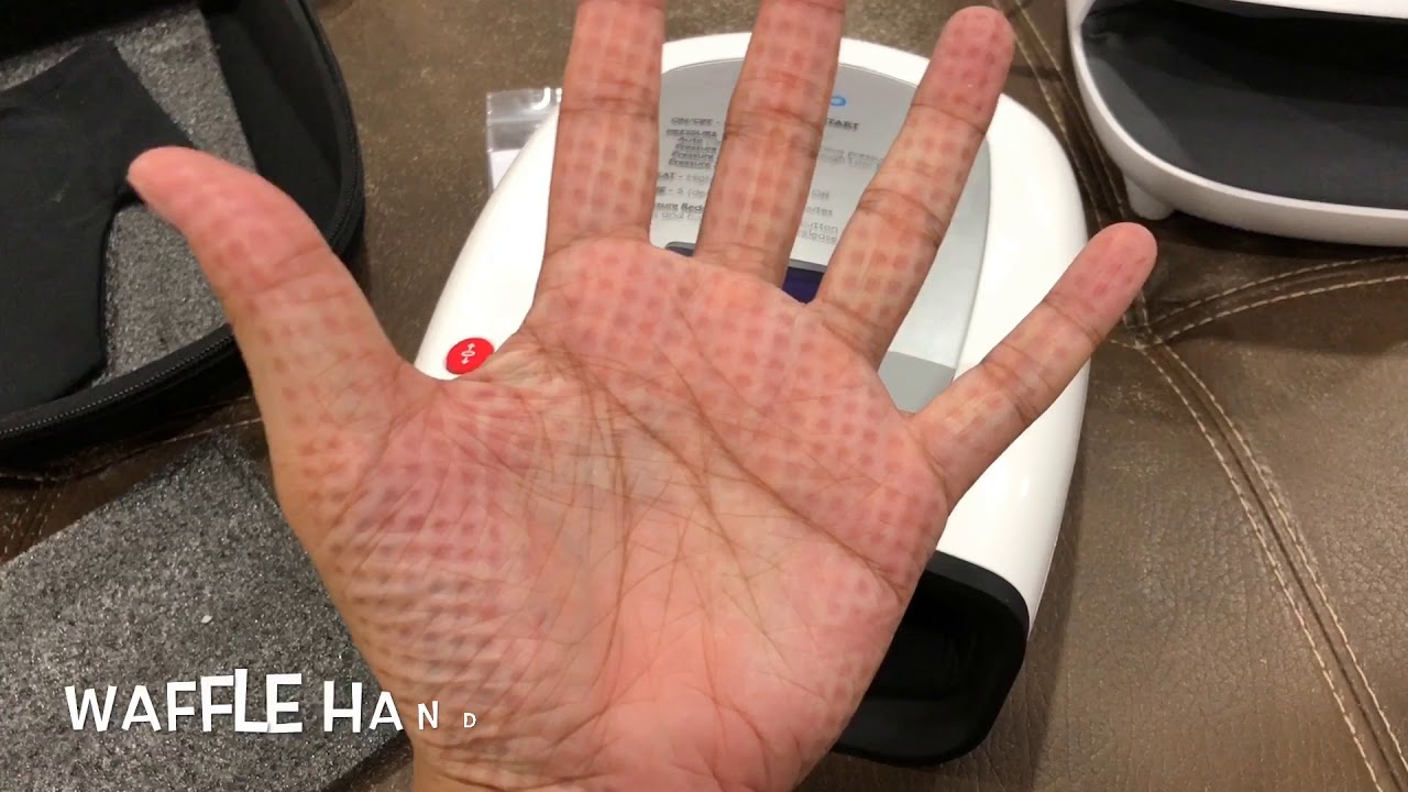 Breo iPalm520 Electric Acupressure Hand Massager