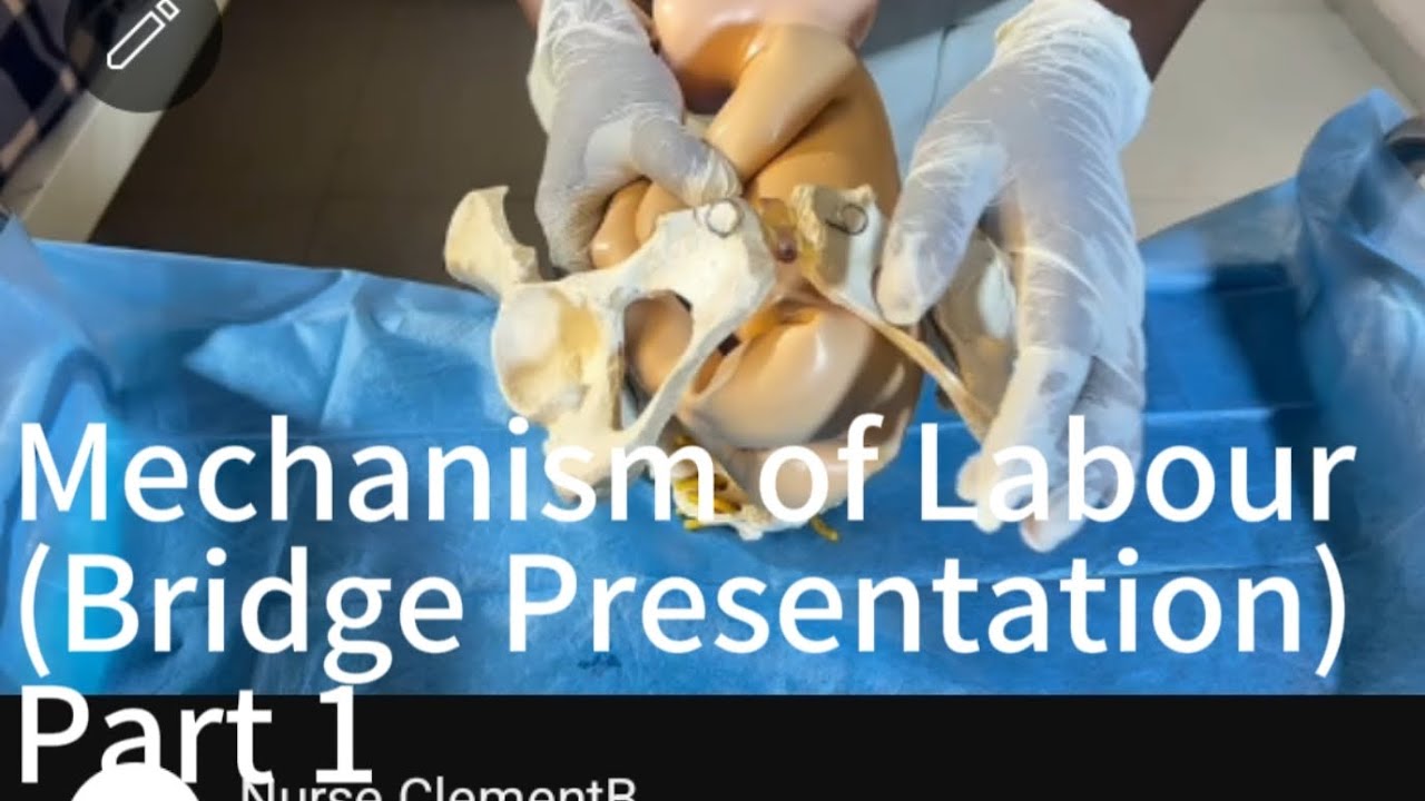 Mechanism of Labour, ( Bridge presentation) Part 1