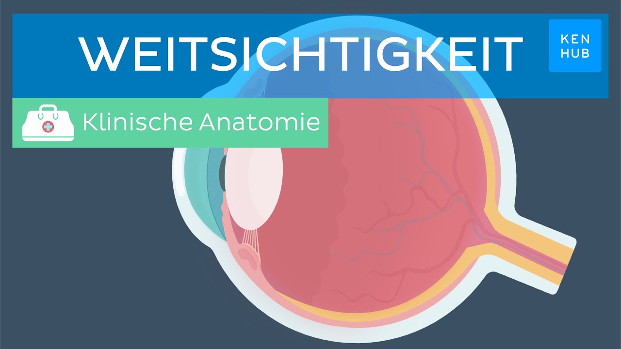 Weitsichtigkeit: Ursachen, Symptome, Behandlung |&nbsp;Kenhub