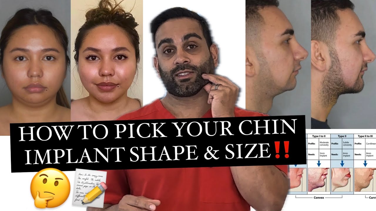 Chin Implant (what size & shape is best for YOU)