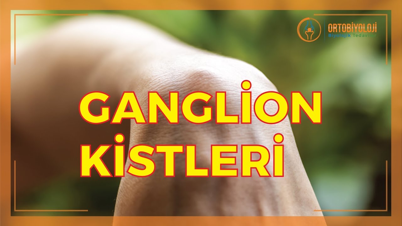 EL ÇEVRESİ ŞİŞLİKLERİ VE GANGLİON KİSTLERİ