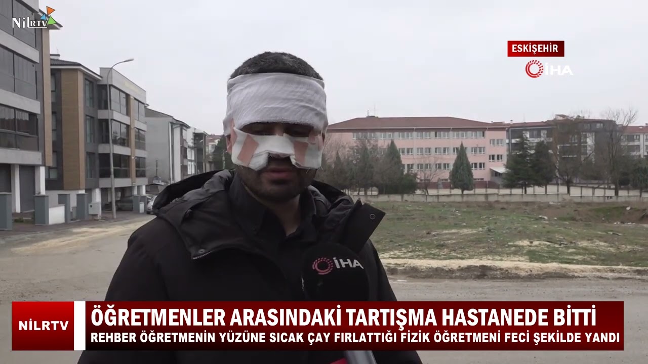 Rehber &Ouml;ğretmeninin Y&uuml;z&uuml;ne Sıcak &Ccedil;ay Fırlattığı Fizik &Ouml;ğretmeni Feci Şekilde Yandı