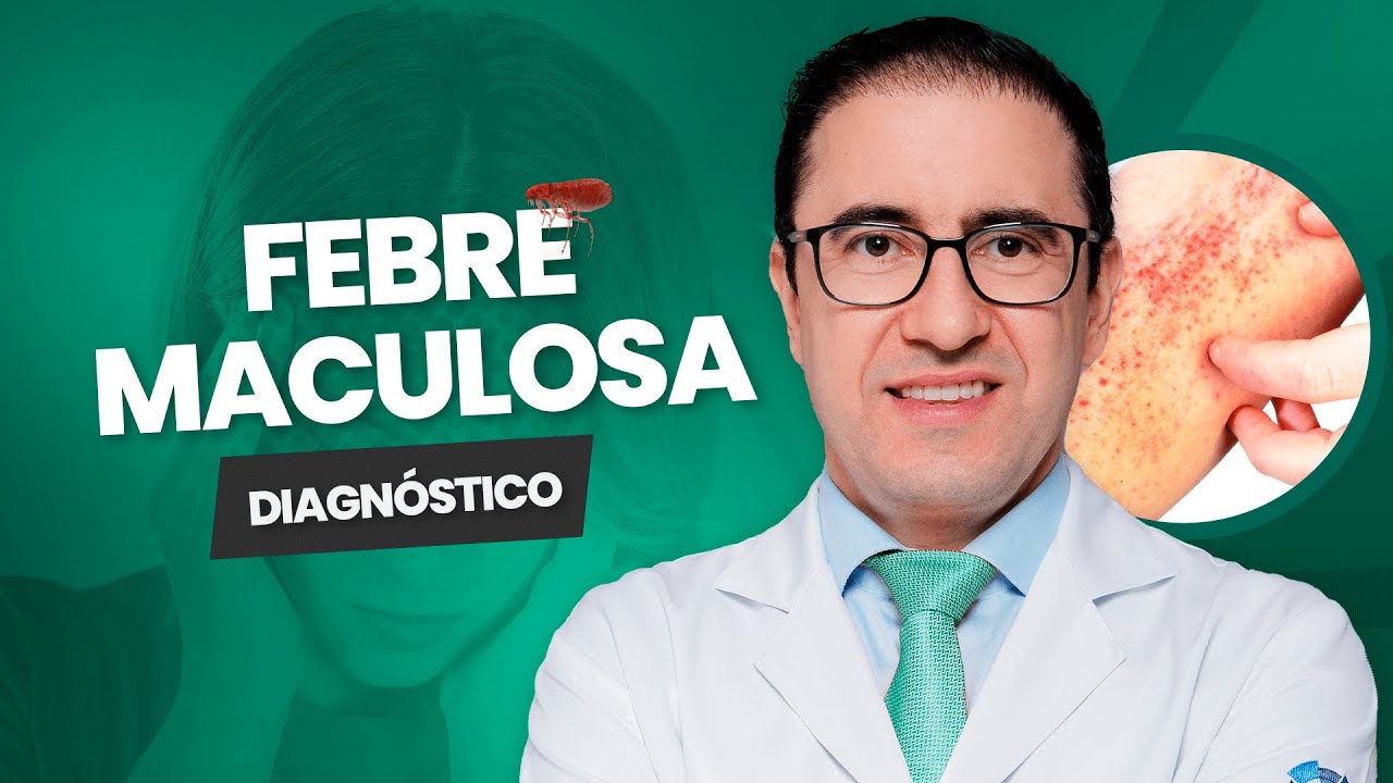 Diagnóstico da Febre Maculosa: Como é feito?