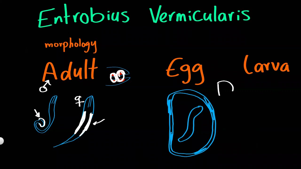 Parasitology 24 E vermicularis & Trypanosomes  »DrMoaz