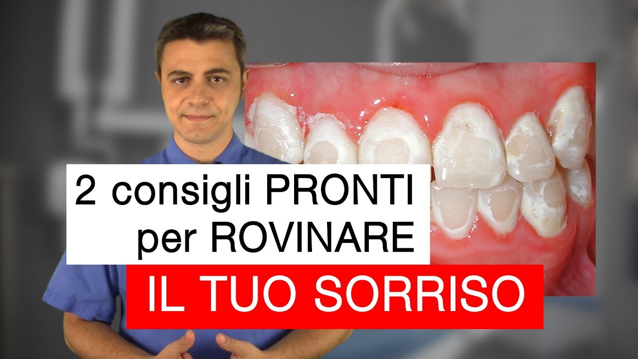 2 consigli pronti per ROVINARE il tuo sorriso (con l'apparecchio fisso)