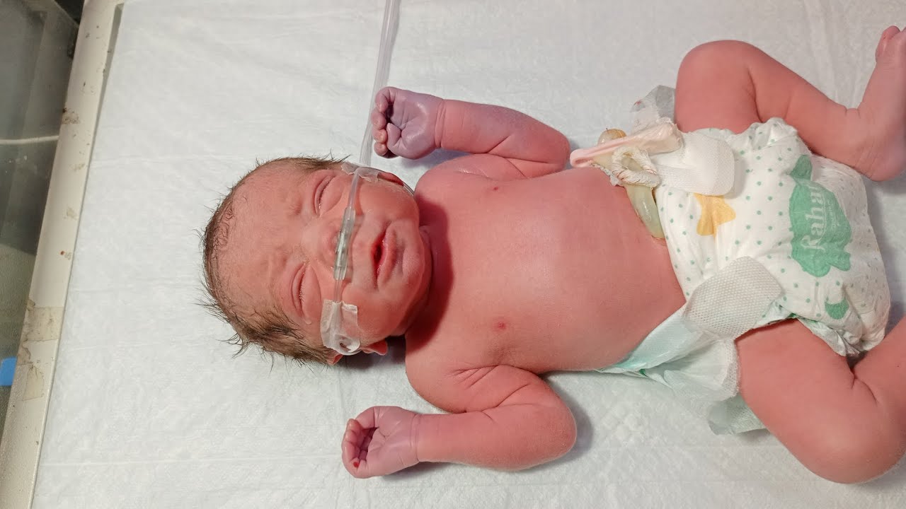 New born baby👶👶👶