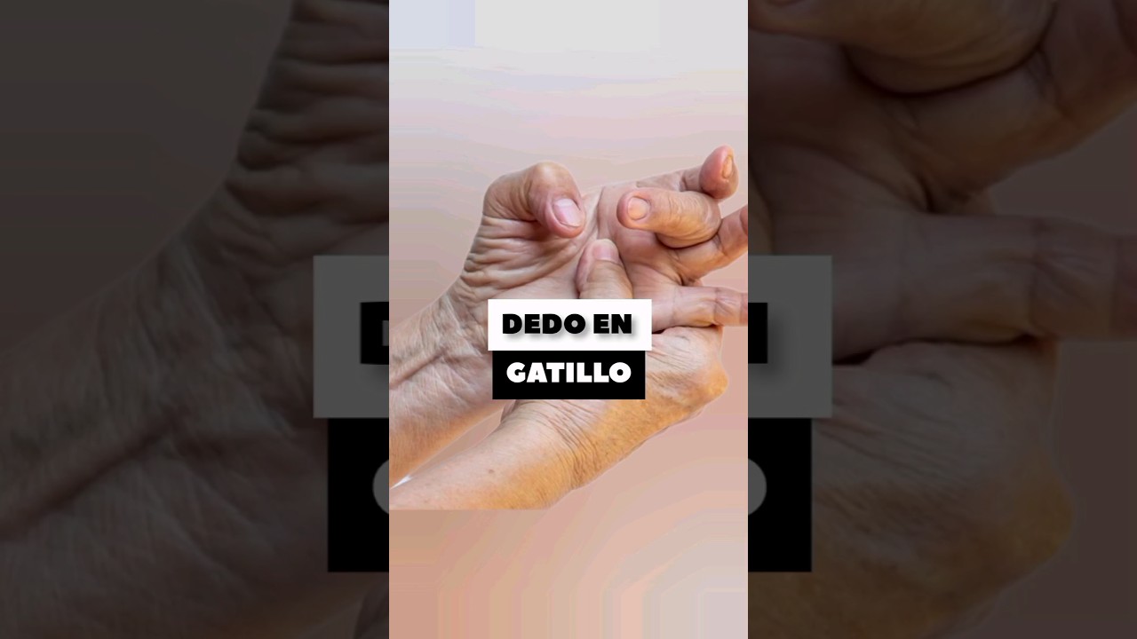 DEDO EN GATILLO