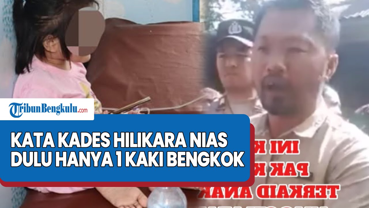 “Dulu 1 kaki Bengkok” Kata Kades Hilikara Nias soal Bocah Perempuan 10 Tahun Dianiaya Keluarga Paman