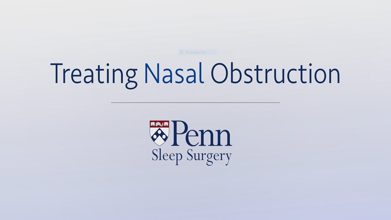 Treating Nasal Obstruction | Penn Sleep Surgery