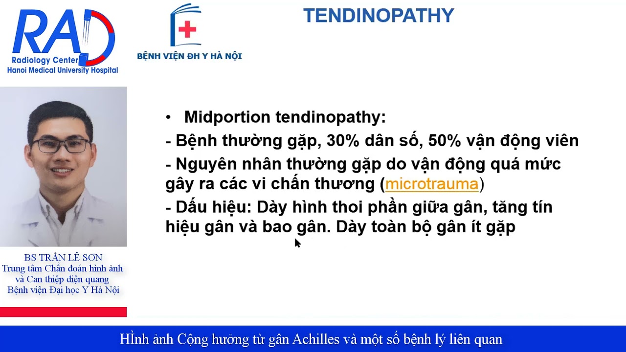 Hình ảnh Cộng hưởng từ gân Achilles và một số bệnh lý liên quan