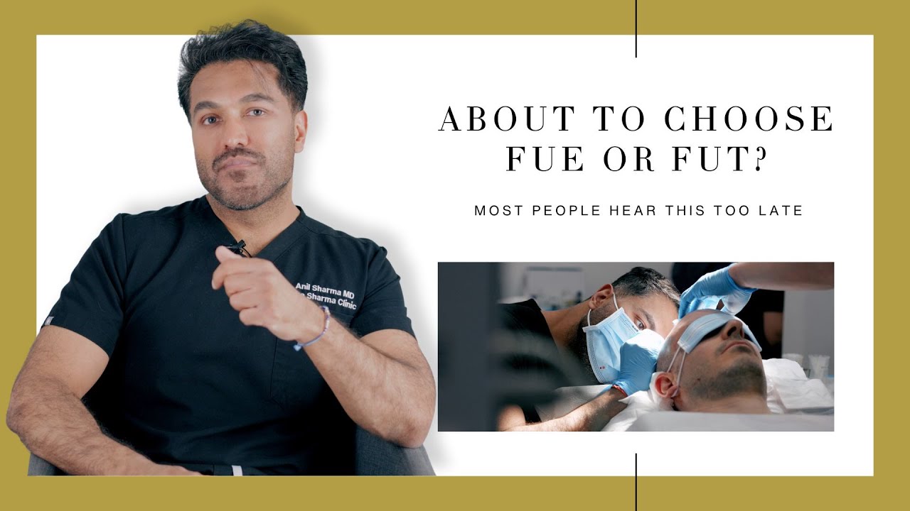 Don’t Pick FUE or FUT Until You See This! FUE vs. FUT Hair Transplant.