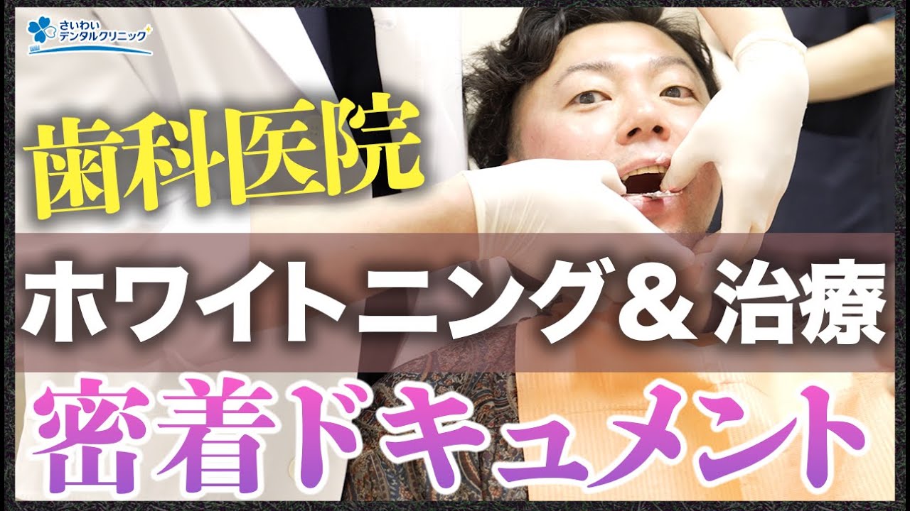 【歯科治療＆ホワイトニング密着】銀歯からセラミックへ＆ホワイトニング治療の全工程を公開