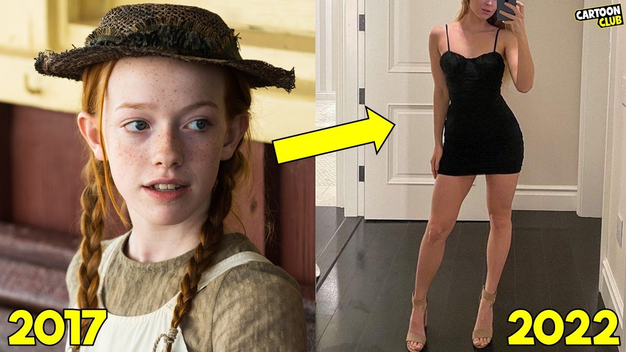 Antes y Después de Anne with an E