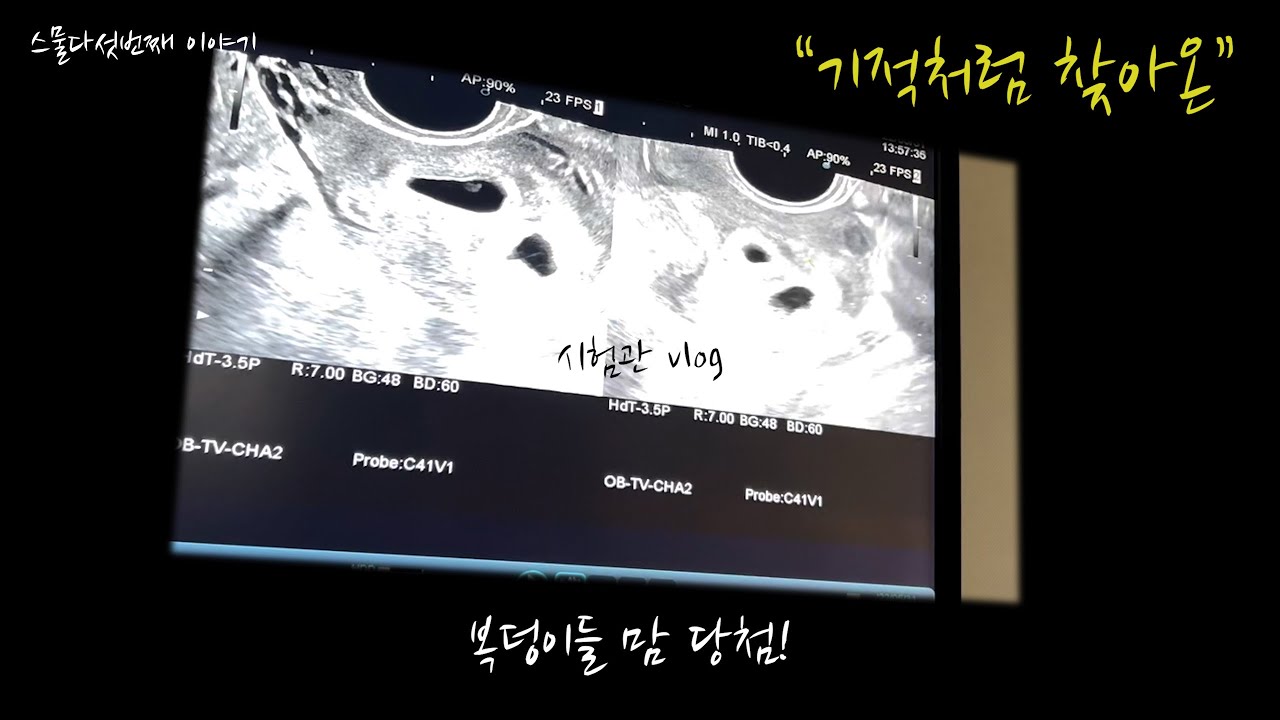 VLOG 내 인생에 쌍둥이라니/1차 시험관 성공 후기/성공하자마자 시작된 입덧 그래도 감사한 요즘