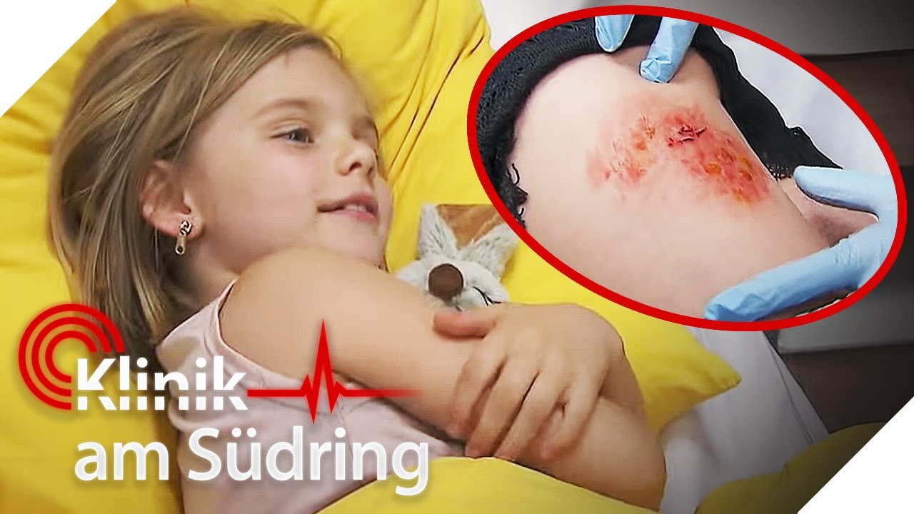 Bakterien im Bein! 🦠 Wieso heilt Annas (6) Wunde einfach nicht? | Klinik am Südring | SAT.1