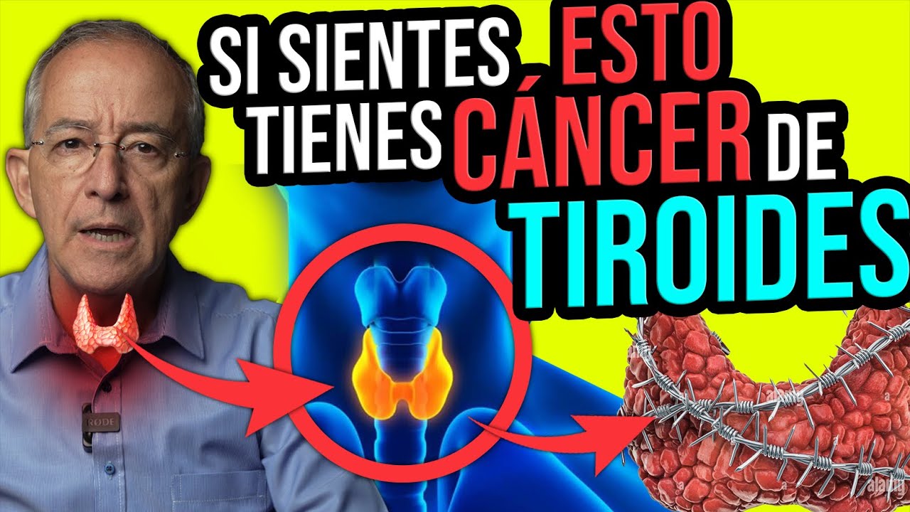 CUIDADO SI SIENTES ESTO TIENES CANCER DE TIROIDES - Oswaldo Restrepo RSC