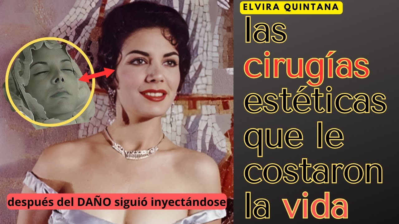 Elvira Quintana/Las CIRUGÍAS estéticas que le costaron la vida/ SIGUIÓ INYECTÁNDOSE DESPUÉS DEL DAÑO