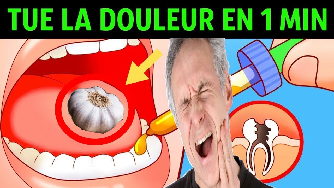 Mal de dent : 8 rem&egrave;des de grand-m&egrave;re tr&egrave;s efficaces