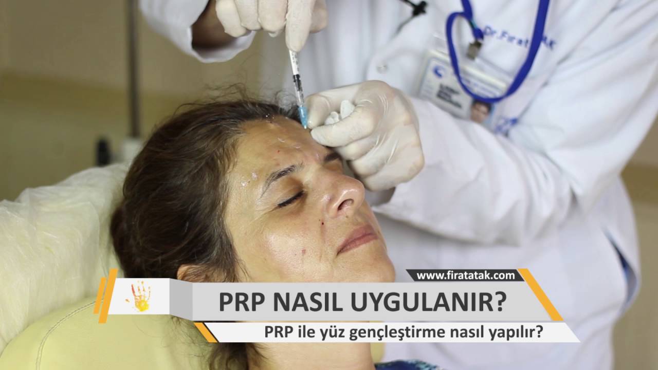 PRP Nasıl Yapılır? Yüz Gençleştirme İçin Cilde Yapılan PRP'yi Uygulamalı İzle