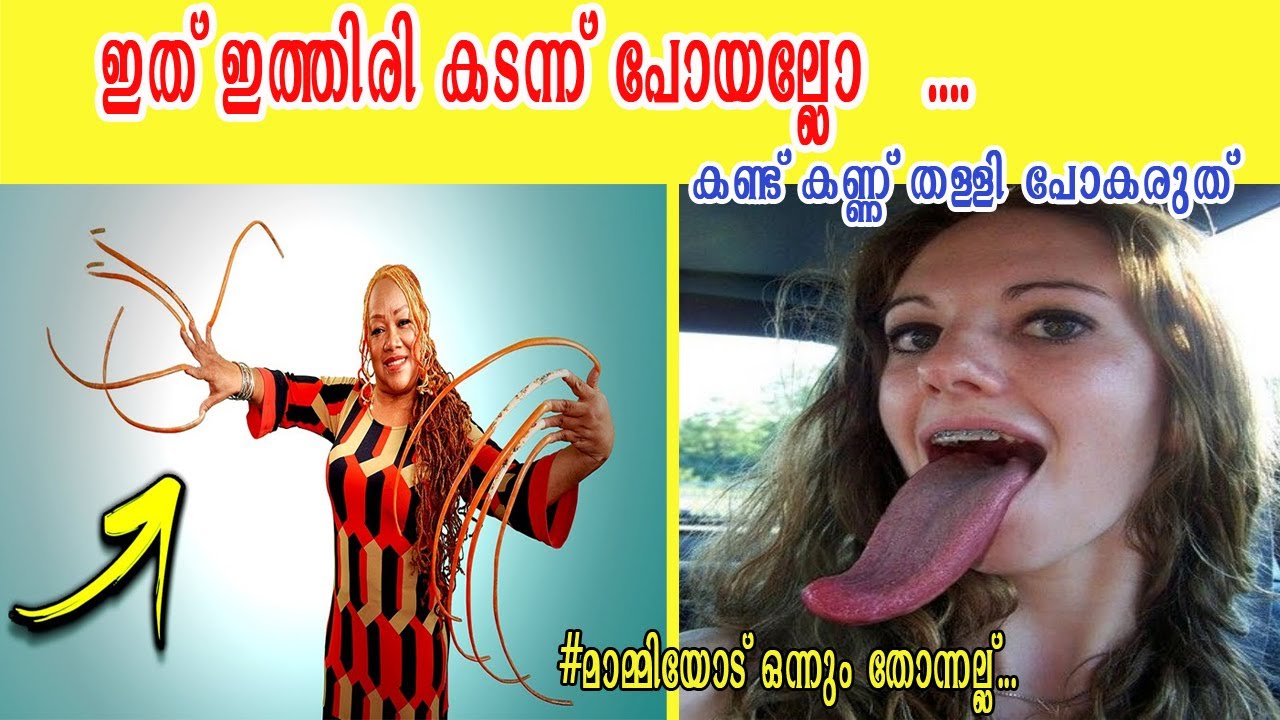 അസാധാരണ വലിപ്പമുള്ള ശരീരഘടനകളാൽ ലോക  റെക്കോർഡുകൾ നേടിയവർ.