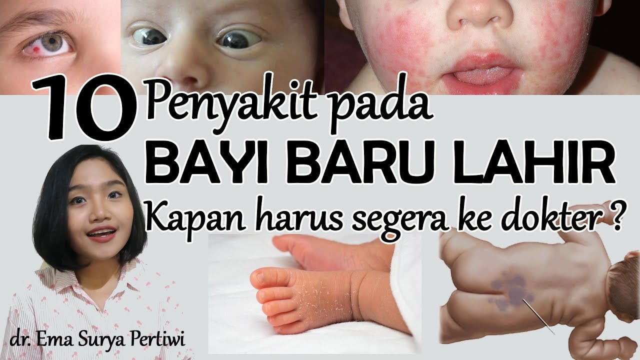 10 Jenis Sakit Bayi Baru Lahir, Kuning Mata Kulit Perut , Kapan di Bawa Kedokter ?