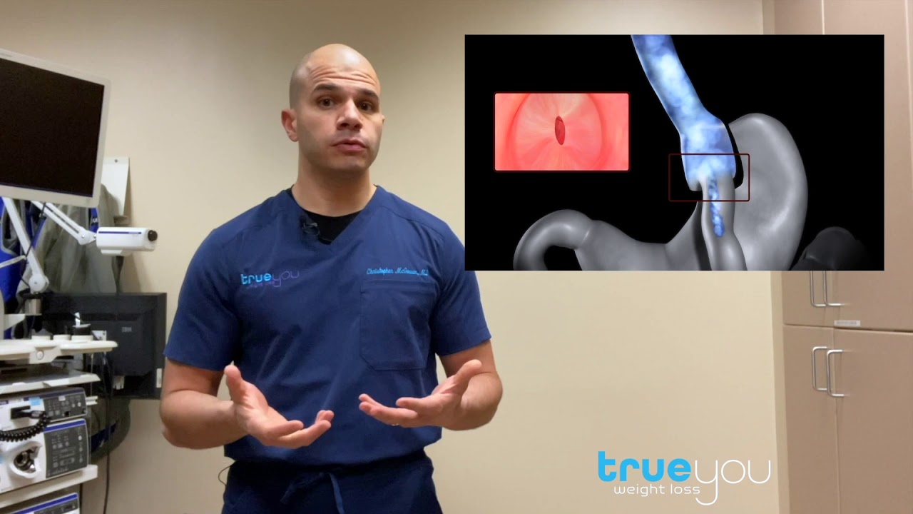 Endoscopic Gastric Bypass Revision Explained | How Transoral Outlet Reduction (TORe) Works