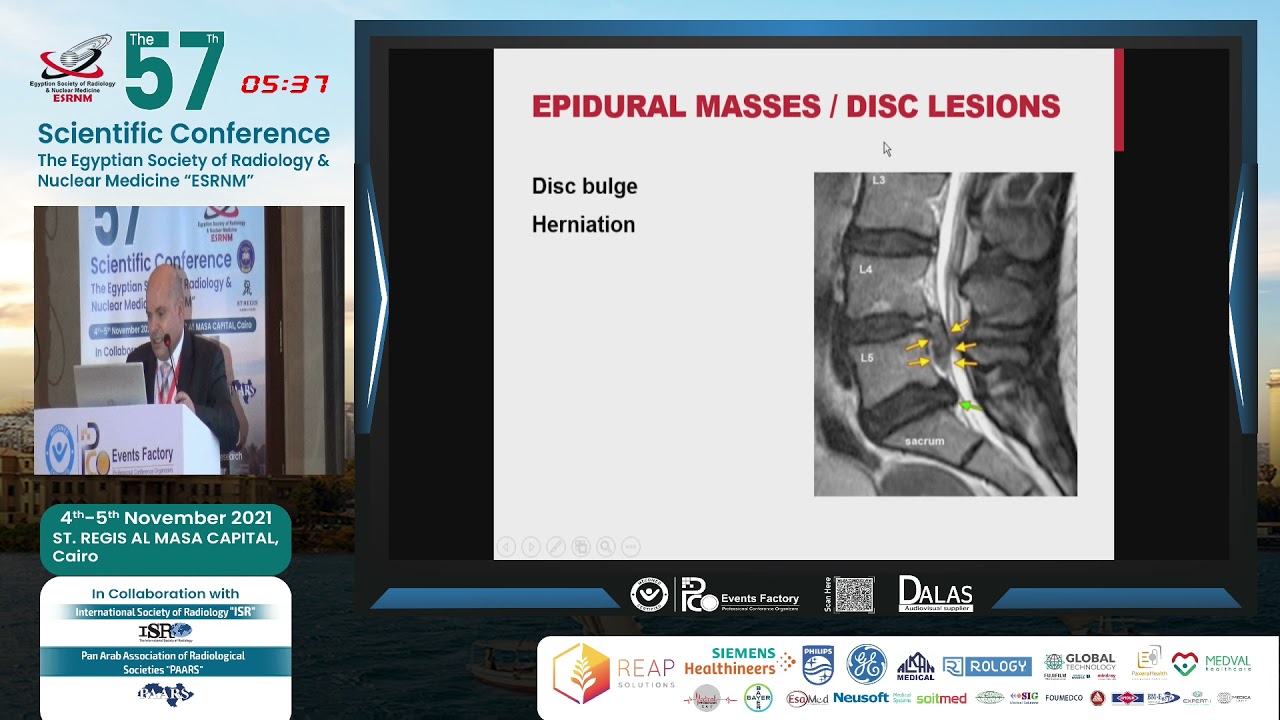 Epidural Masses / Disc Lesions