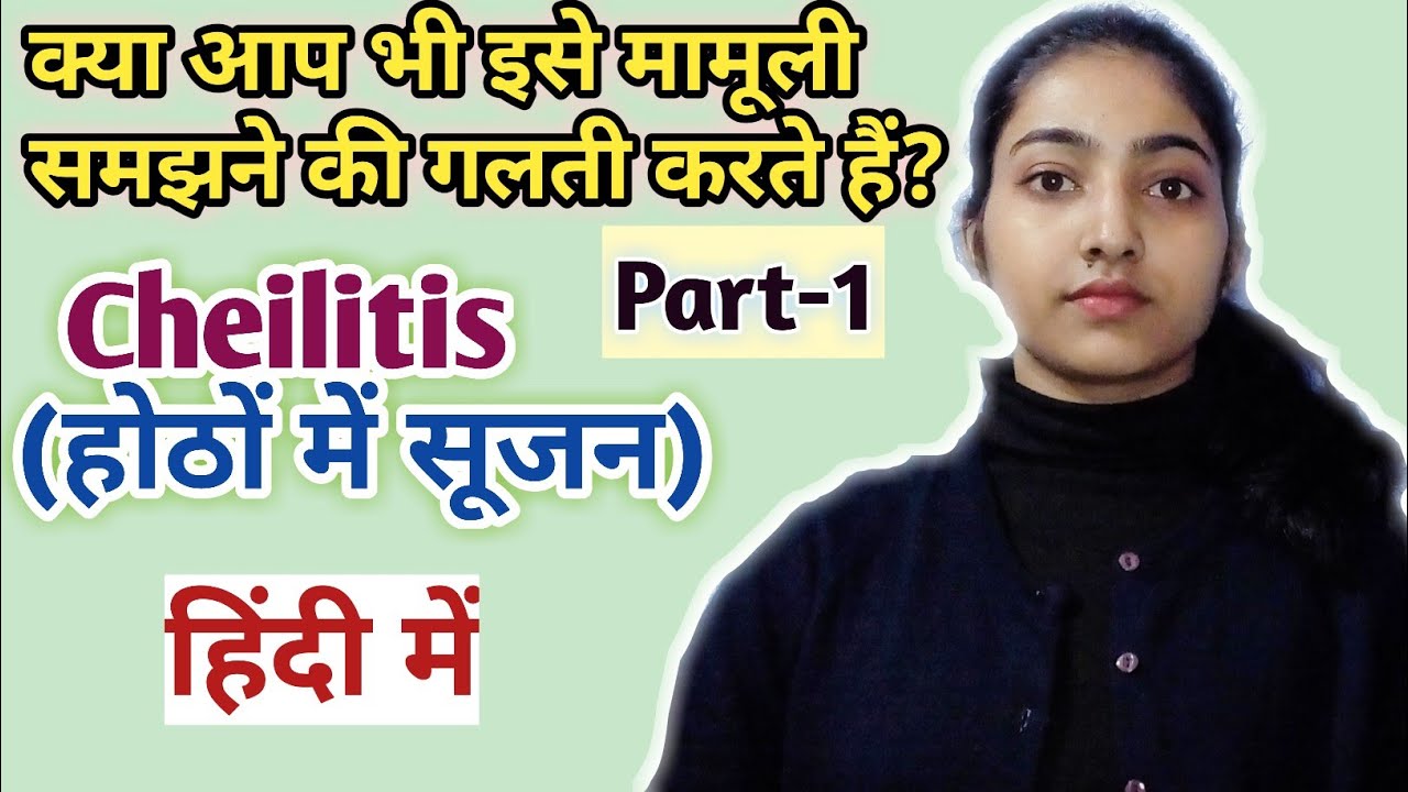 Cheilitis in hindi |Causes|Types|Symptoms|Treatment|Msn|