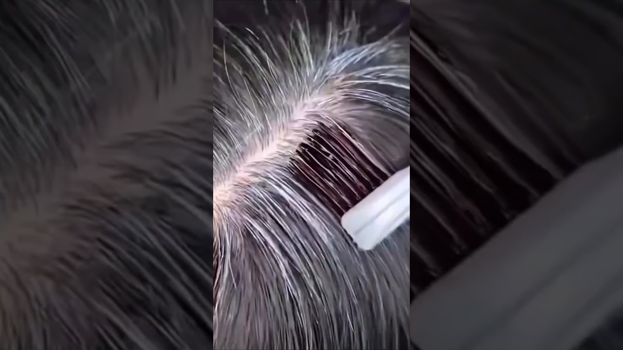Elimina las canas con esta poderosa mezcla #consejos #tips #sabiasque #recetas #trucos