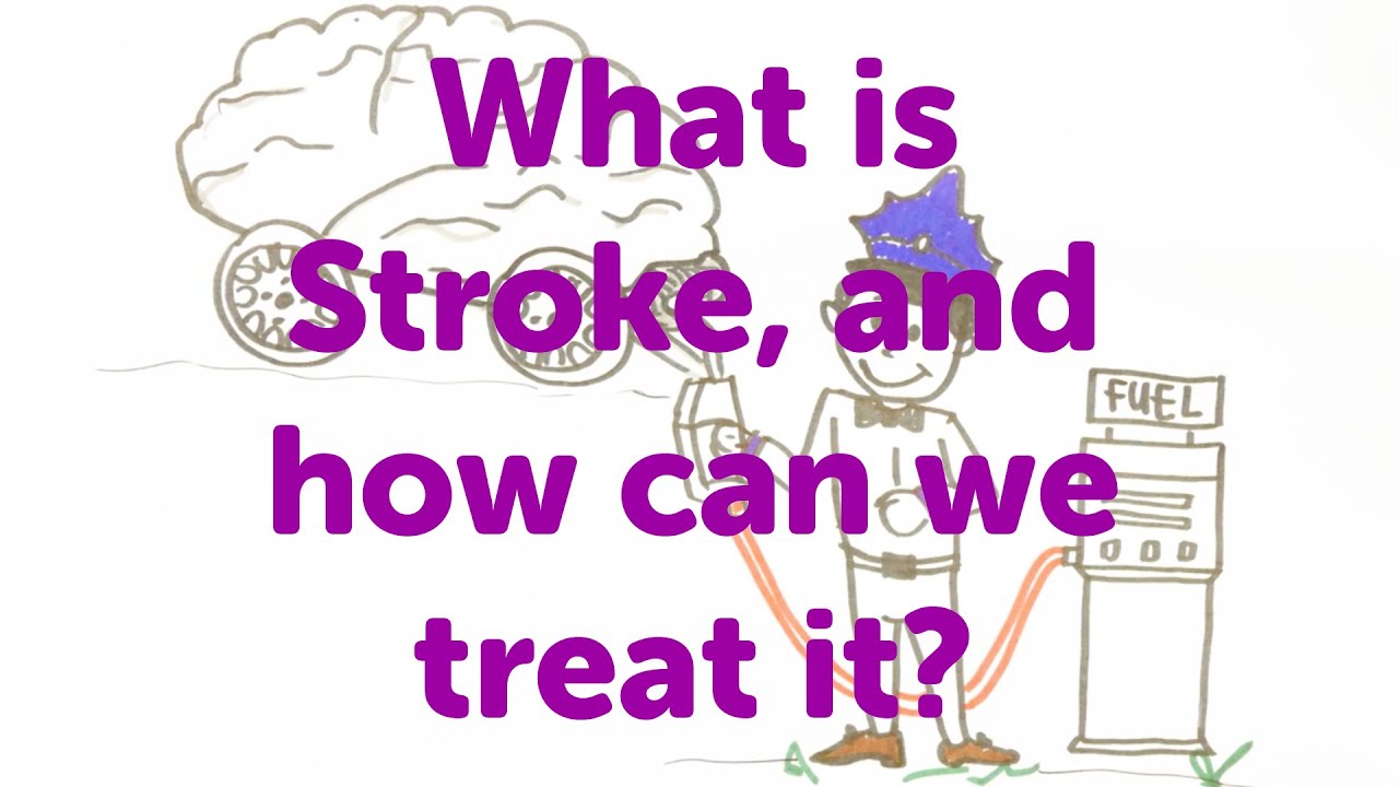 Minute Lectures: What is Stroke, and how can we treat it?